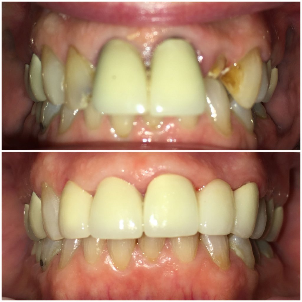Before and After Image