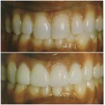 Before and After Image